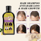 Shampoo Anticaída de Jengibre